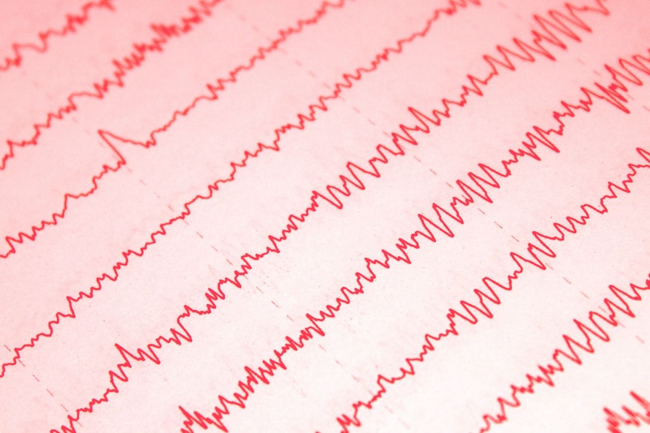 Innowacyjne urządzenia do terapii neurofeedback: jak mogą pomóc w poprawie samopoczucia?
