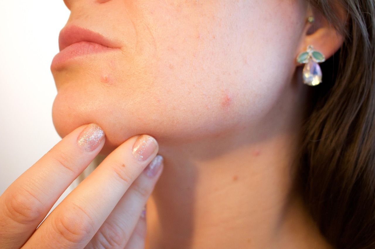 Czy telemedycyna to przyszłość dermatologii? Zalety konsultacji online.